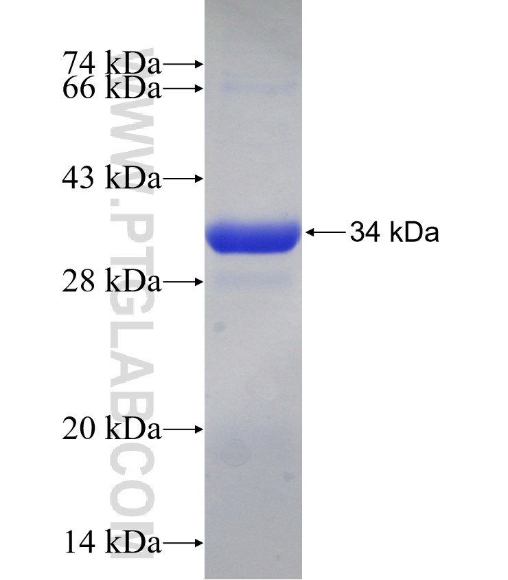 SLC4A3 fusion protein Ag25479 SDS-PAGE