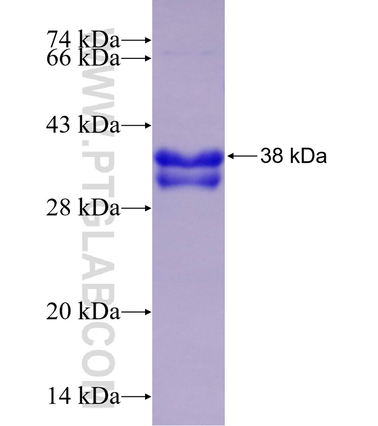 SLC5A1 fusion protein Ag29338 SDS-PAGE