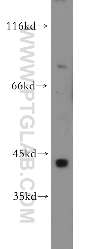 Western Blot (WB) analysis of mouse small intestine tissue using SLC5A3 Polyclonal antibody (21628-1-AP)