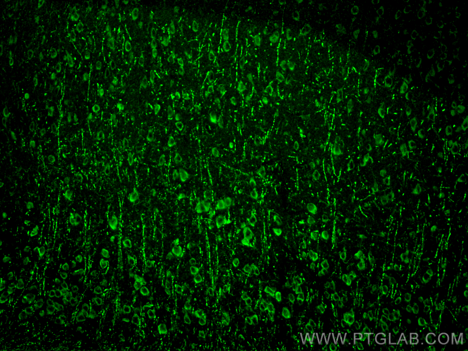 Immunofluorescence (IF) / fluorescent staining of mouse brain tissue using CHT1 Polyclonal antibody (21848-1-AP)