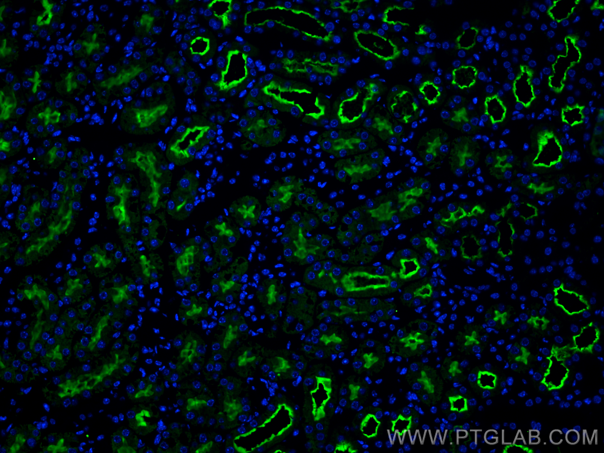 Immunofluorescence (IF) / fluorescent staining of mouse kidney tissue using SLC5A8 Polyclonal antibody (21433-1-AP)