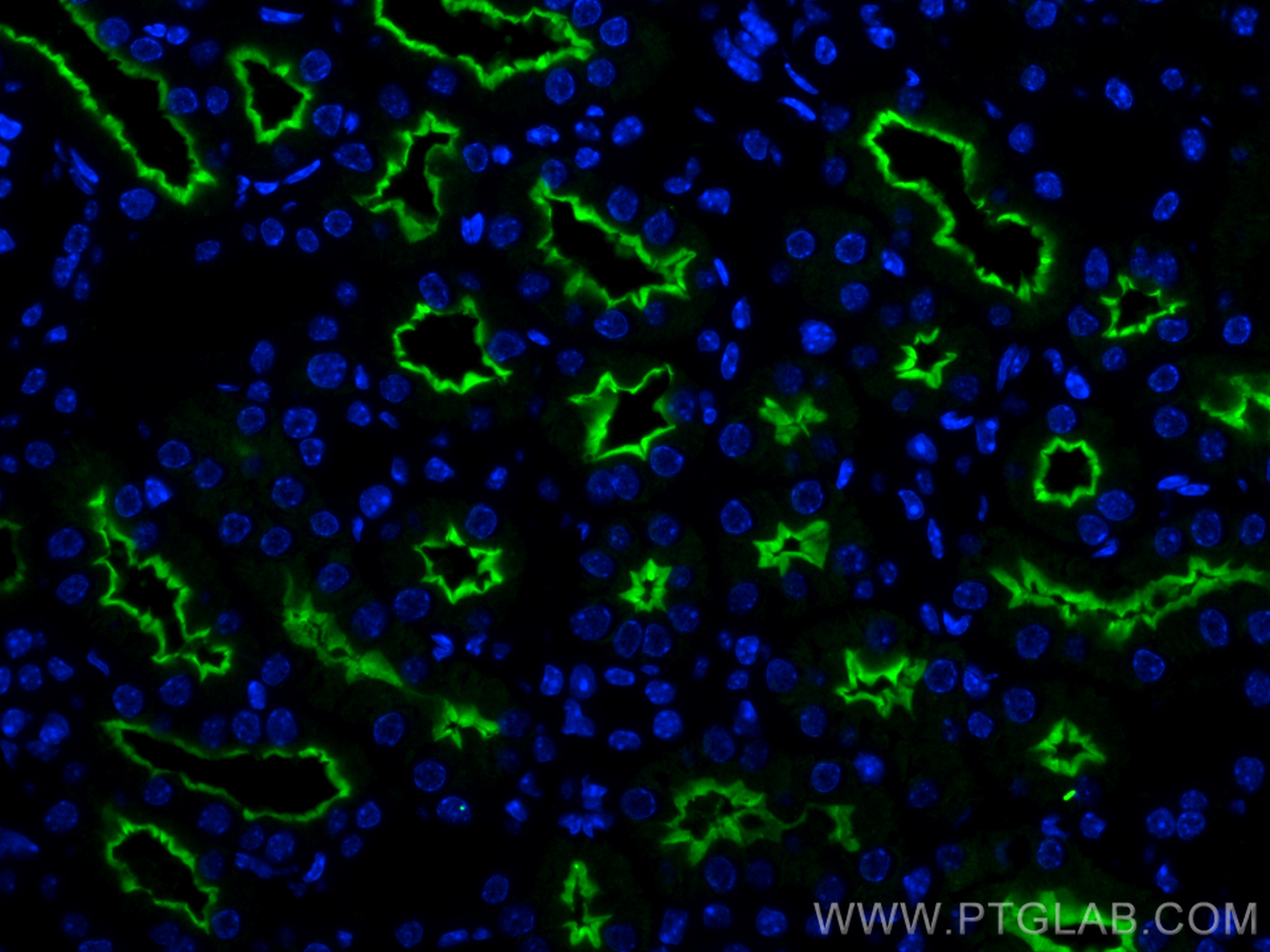 Immunofluorescence (IF) / fluorescent staining of mouse kidney tissue using SLC5A8 Polyclonal antibody (21433-1-AP)