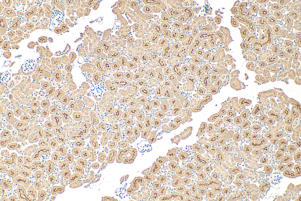 Immunohistochemistry (IHC) staining of mouse kidney tissue using SLC5A8 Polyclonal antibody (21433-1-AP)