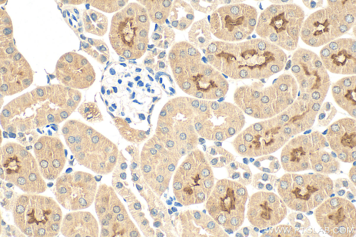 Immunohistochemistry (IHC) staining of mouse kidney tissue using SLC5A8 Polyclonal antibody (21433-1-AP)