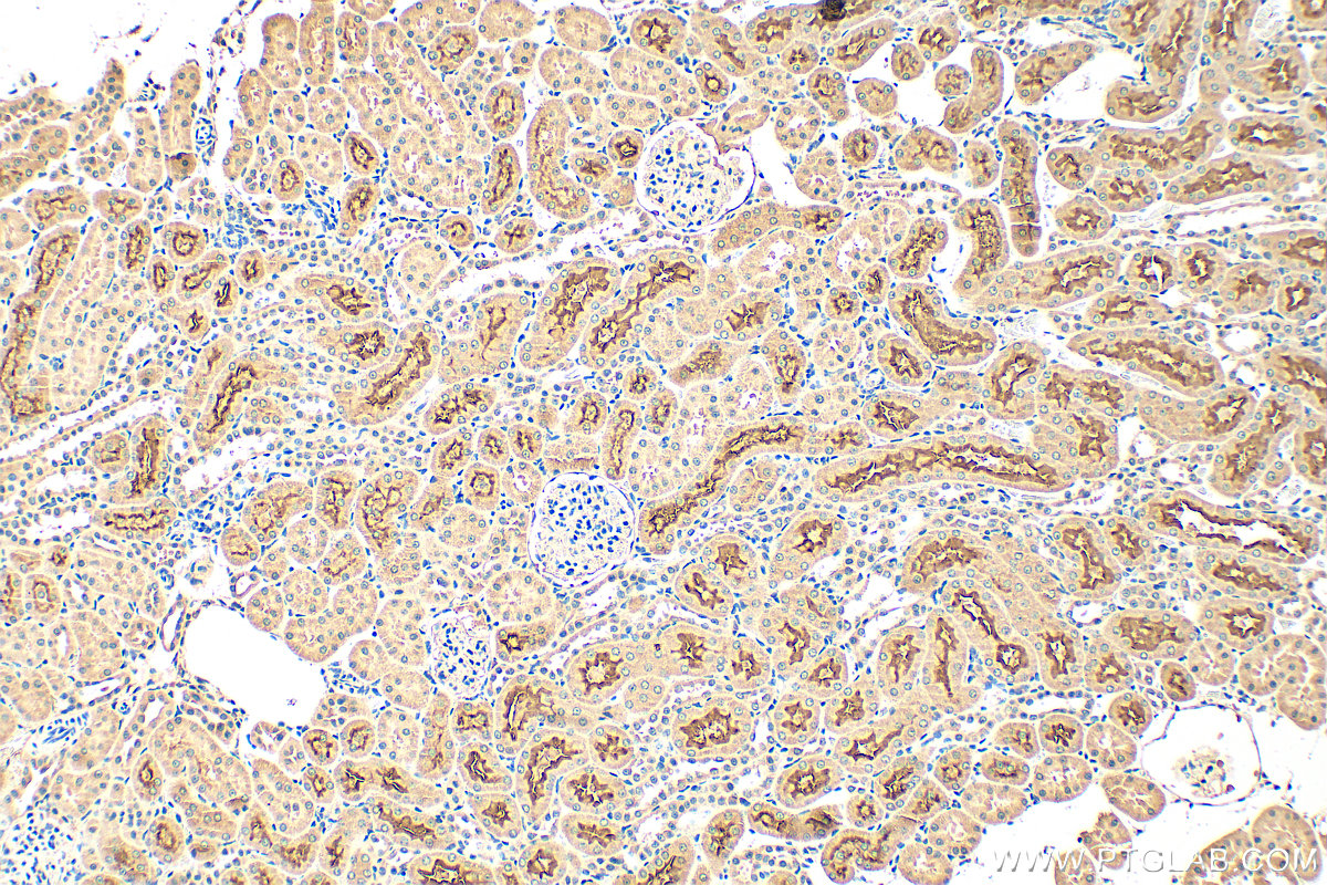 Immunohistochemistry (IHC) staining of rat kidney tissue using SLC5A8 Polyclonal antibody (21433-1-AP)