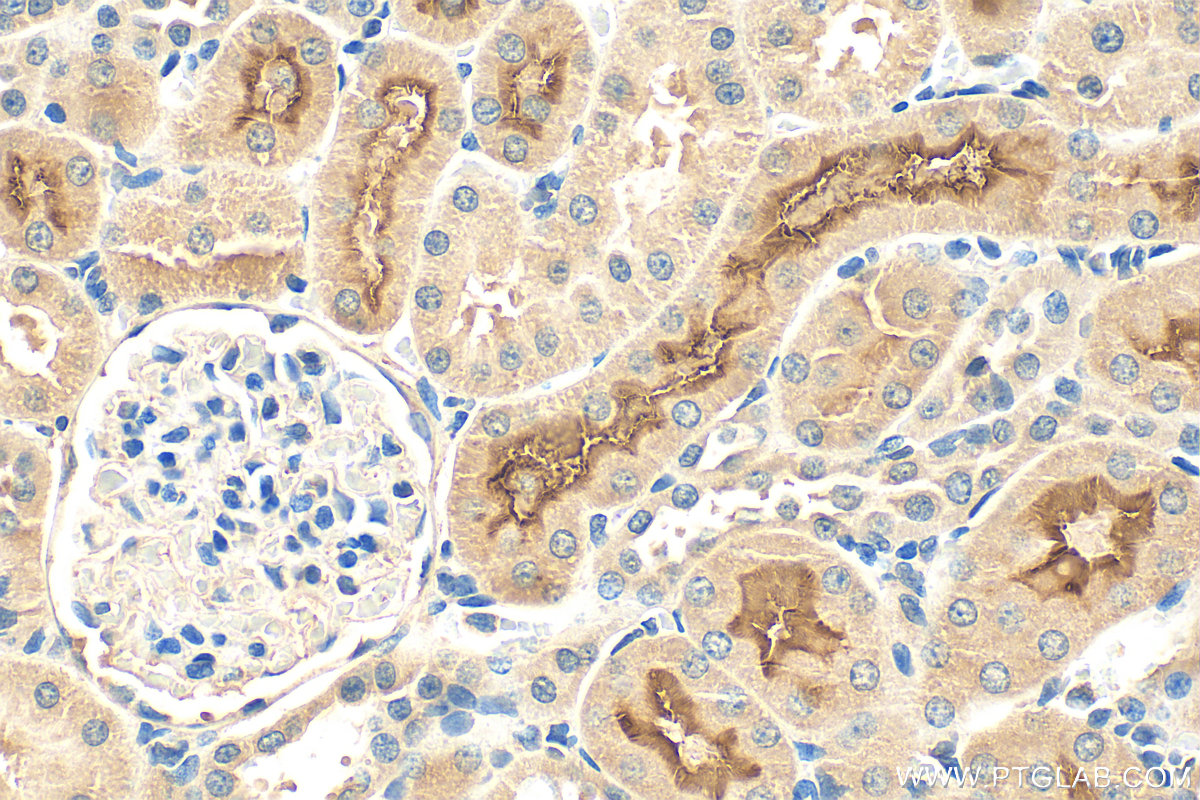 Immunohistochemistry (IHC) staining of rat kidney tissue using SLC5A8 Polyclonal antibody (21433-1-AP)