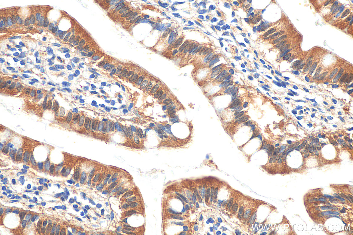 Immunohistochemistry (IHC) staining of human small intestine tissue using SLC6A19 Polyclonal antibody (27575-1-AP)