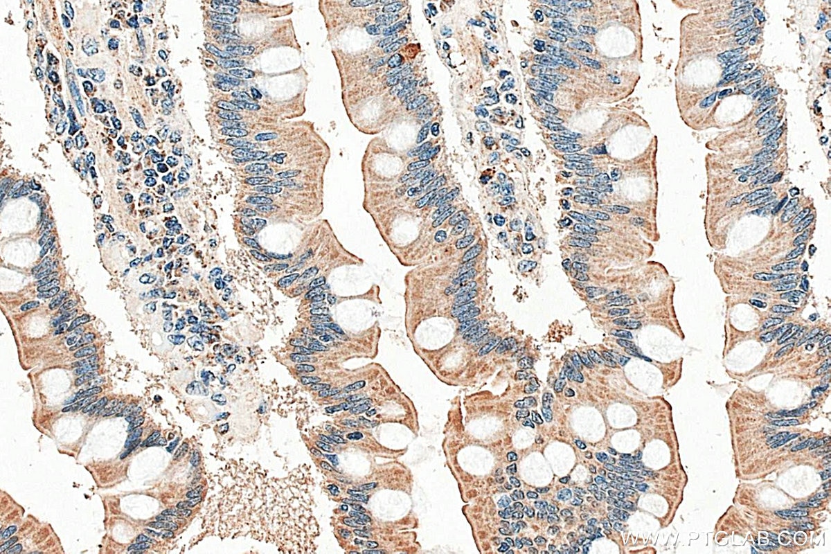 Immunohistochemistry (IHC) staining of human small intestine tissue using SLC6A19 Polyclonal antibody (29372-1-AP)