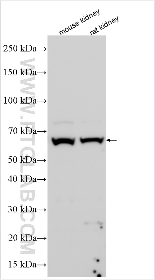 Western Blot (WB) analysis of various lysates using SLC6A19 Polyclonal antibody (29372-1-AP)