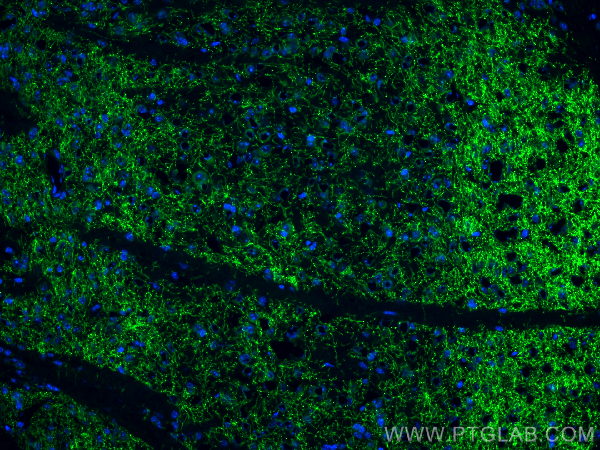 Immunofluorescence (IF) / fluorescent staining of mouse brain tissue using Dopamine Transporter/DAT Polyclonal antibody (22524-1-AP)