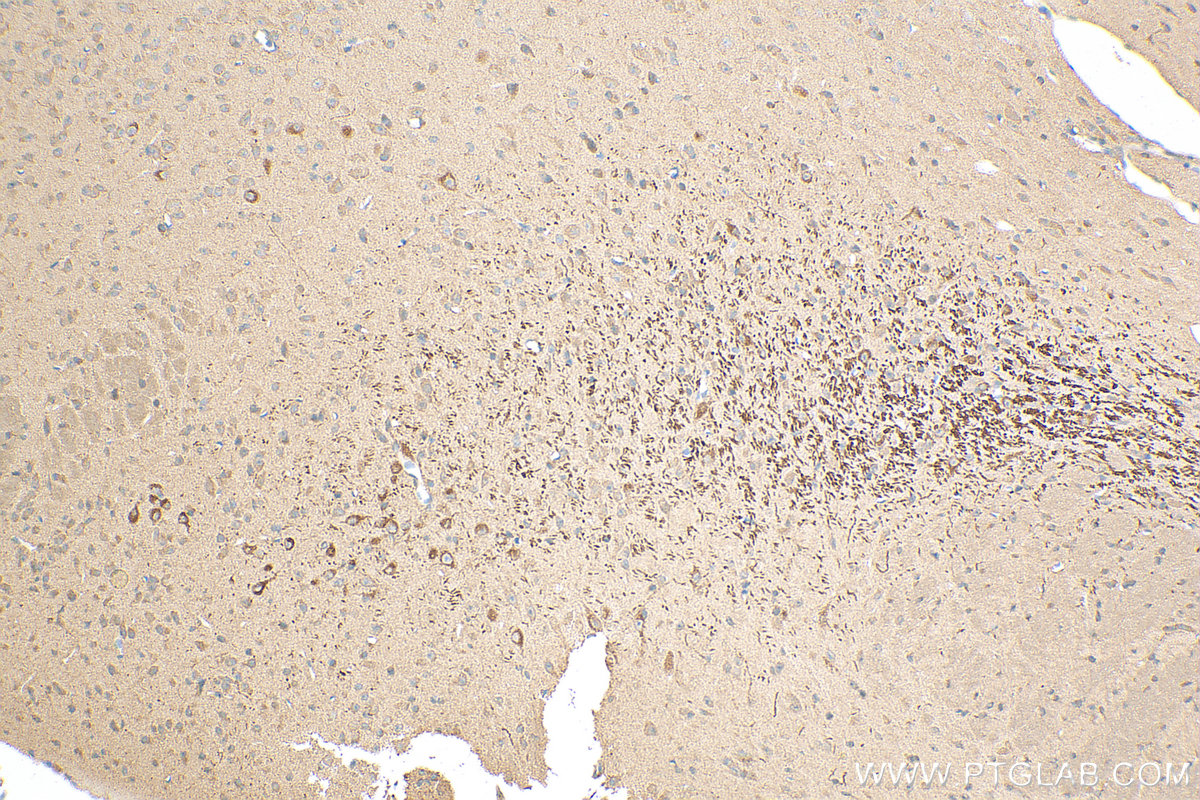 Immunohistochemistry (IHC) staining of mouse brain tissue using DAT Polyclonal antibody (22524-1-AP)
