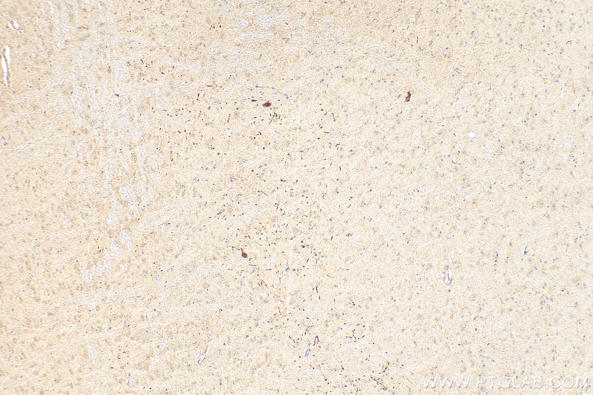 Immunohistochemistry (IHC) staining of mouse brain tissue using Dopamine Transporter/DAT Polyclonal antibody (22524-1-AP)