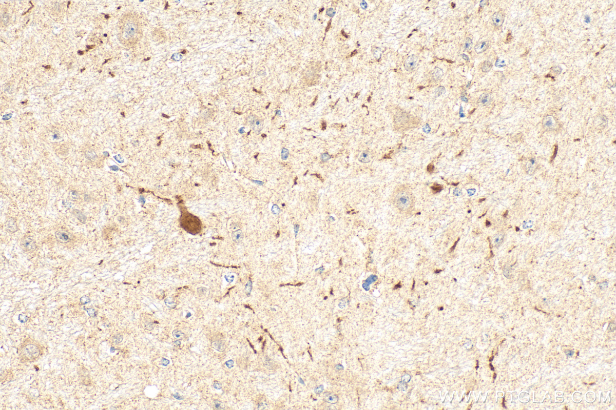 Immunohistochemistry (IHC) staining of mouse brain tissue using Dopamine Transporter/DAT Polyclonal antibody (22524-1-AP)