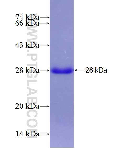 SLC6A5 fusion protein Ag28774 SDS-PAGE