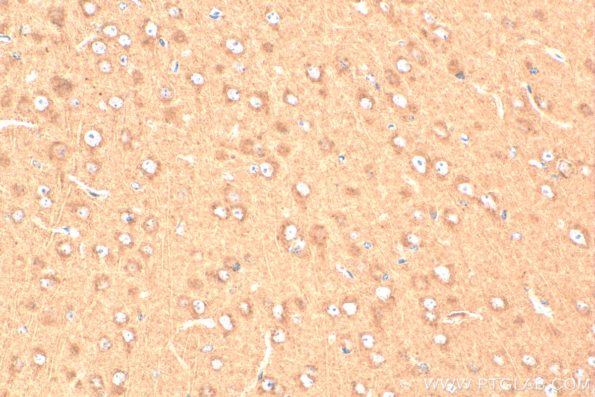 Immunohistochemistry (IHC) staining of mouse brain tissue using SLC6A8 Polyclonal antibody (20299-1-AP)