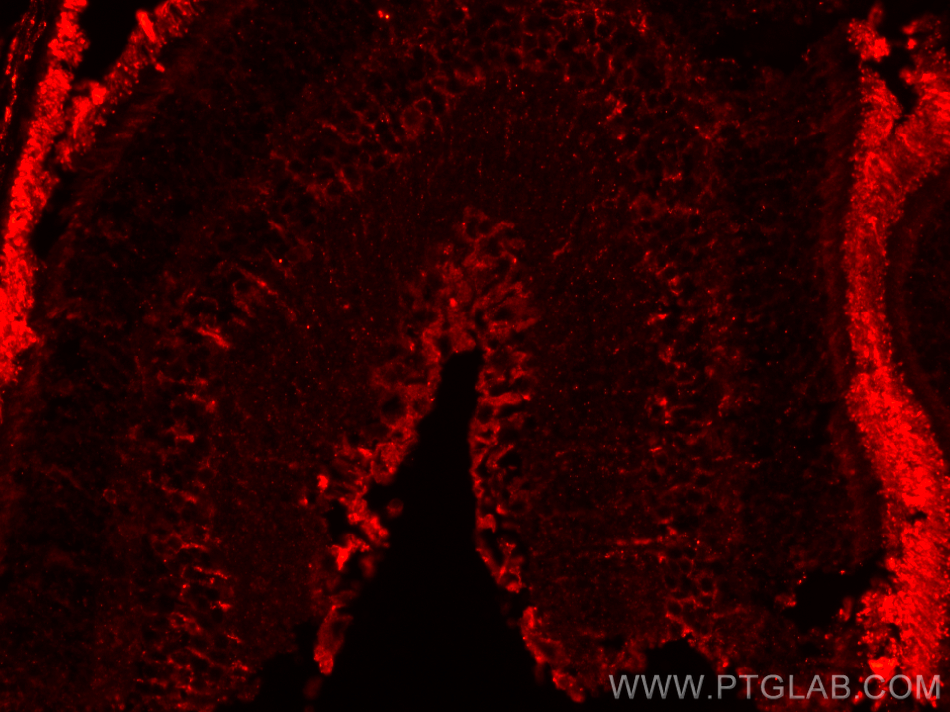 Immunofluorescence (IF) / fluorescent staining of mouse eye tissue using SLC7A11/xCT Polyclonal antibody (32384-1-AP)