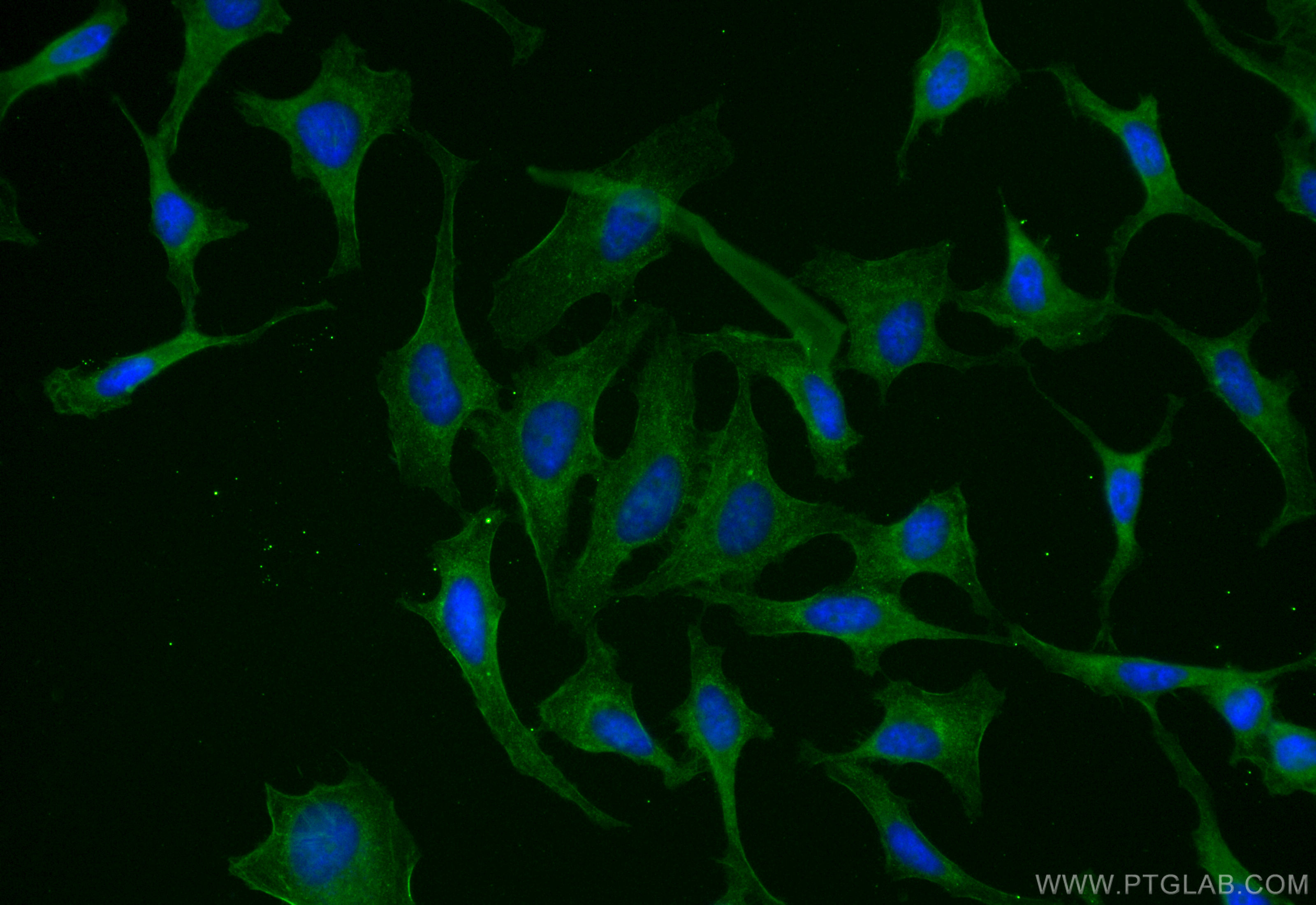 Immunofluorescence (IF) / fluorescent staining of HeLa cells using CoraLite® Plus 488-conjugated SLC7A11/xCT Recombin (CL488-82115-2)