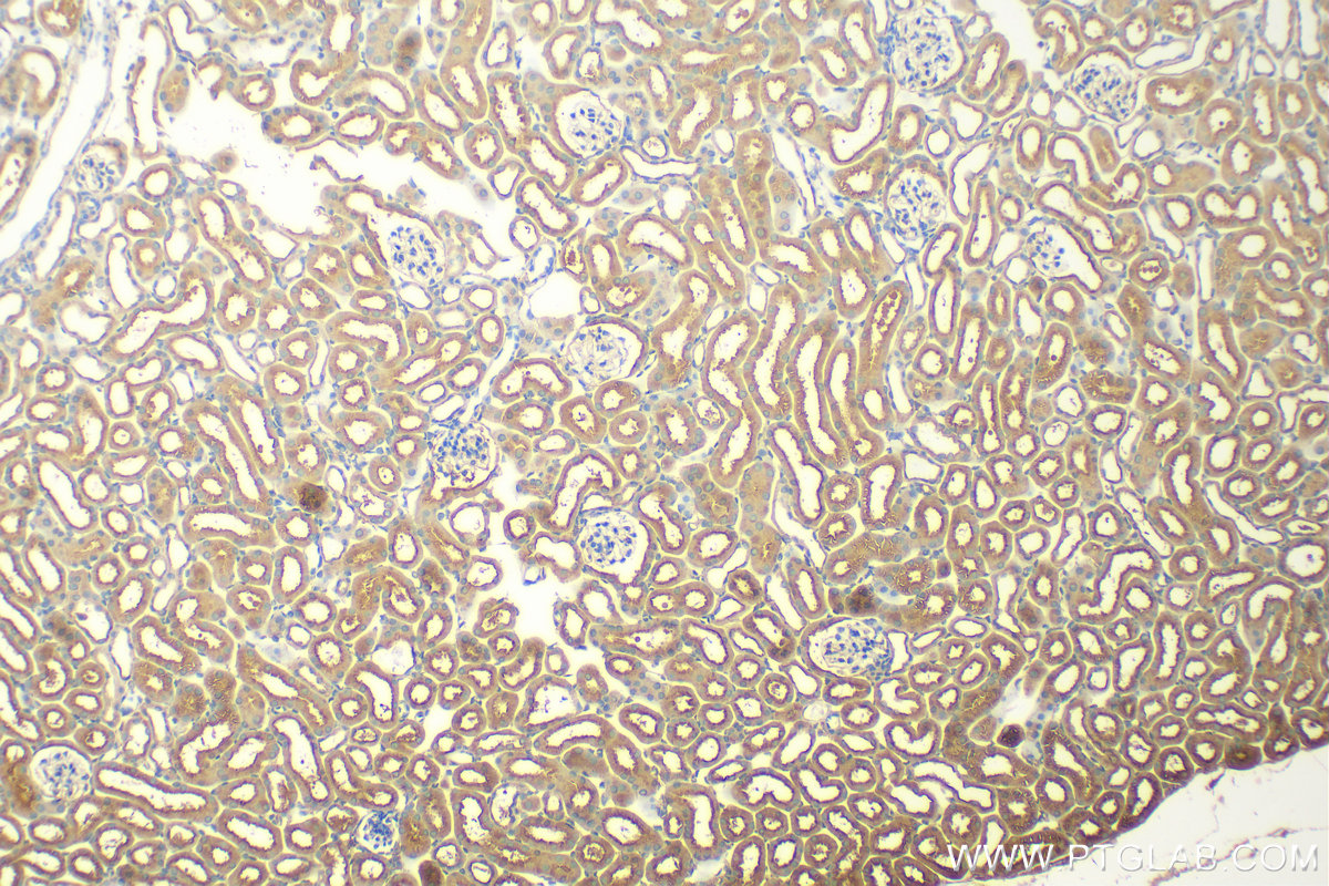 Immunohistochemistry (IHC) staining of mouse kidney tissue using SLC7A13 Polyclonal antibody (32002-1-AP)