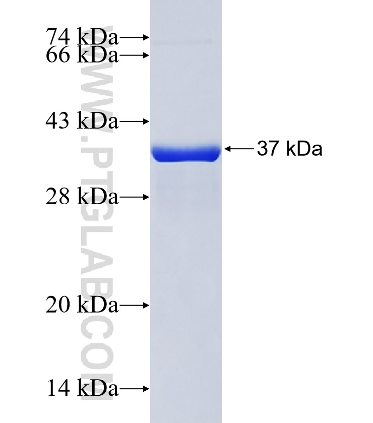 SLC7A3 fusion protein Ag25494 SDS-PAGE