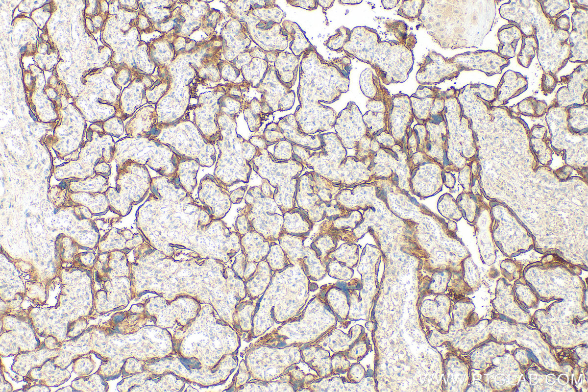 Immunohistochemistry (IHC) staining of human placenta tissue using SLC7A5 Polyclonal antibody (28670-1-AP)