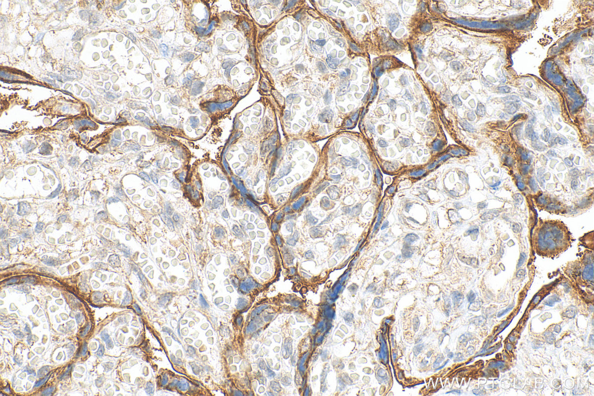 Immunohistochemistry (IHC) staining of human placenta tissue using SLC7A5 Polyclonal antibody (28670-1-AP)