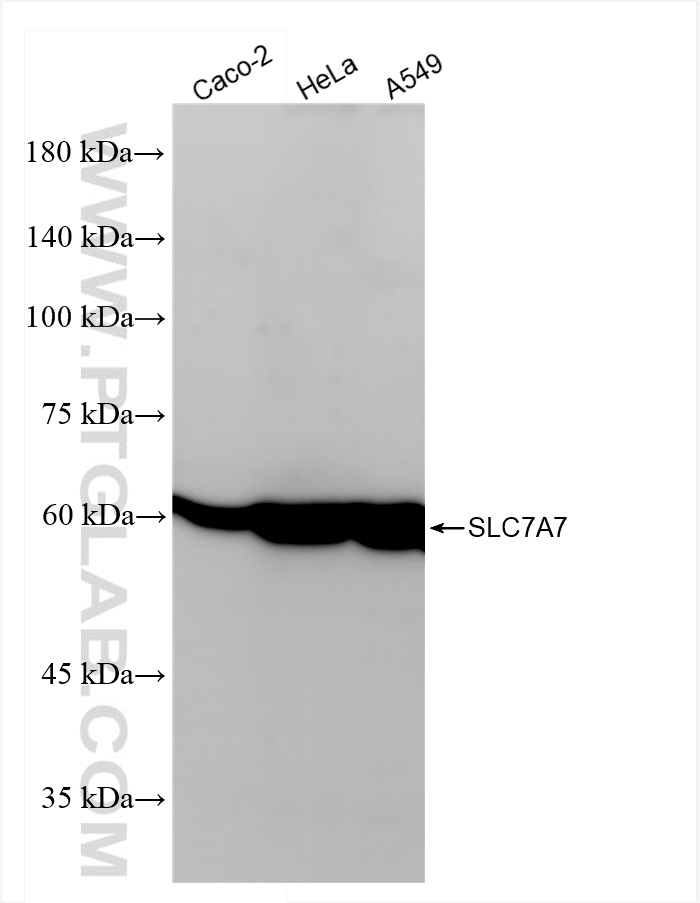 Western Blot (WB) analysis of various lysates using SLC7A7 Recombinant antibody (84743-1-RR)