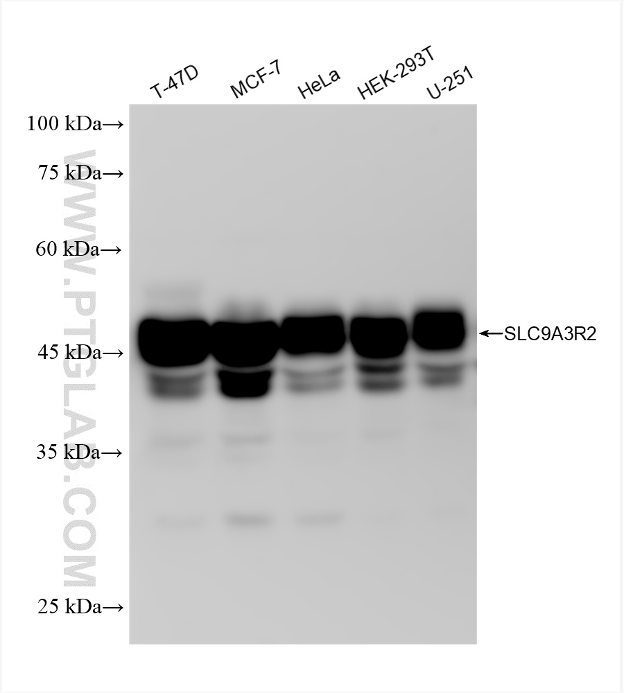 Western Blot (WB) analysis of various lysates using SLC9A3R2 Recombinant antibody (84060-5-RR)