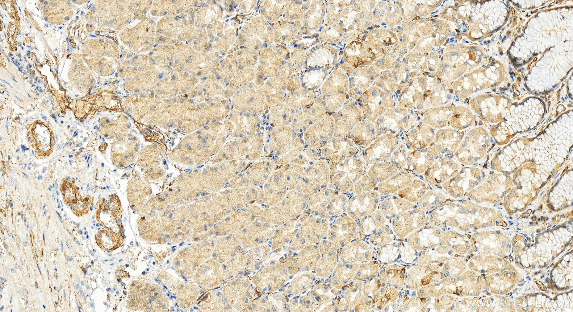 Immunohistochemistry (IHC) staining of human stomach tissue using PGT Polyclonal antibody (14327-1-AP)