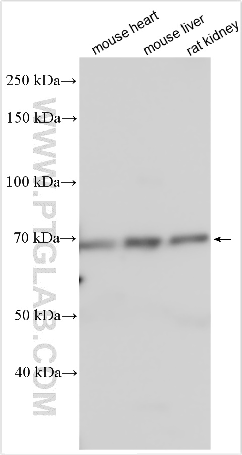 Western Blot (WB) analysis of various lysates using PGT Polyclonal antibody (14327-1-AP)