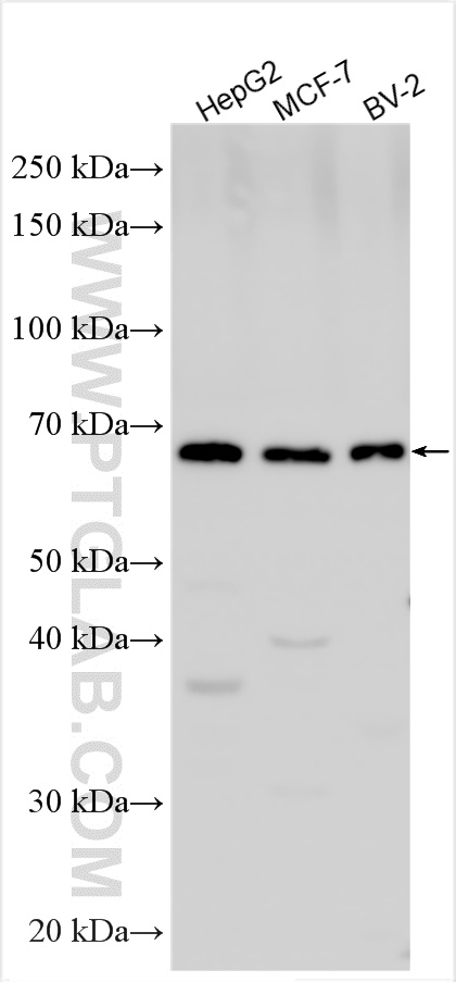 Western Blot (WB) analysis of various lysates using SLCO2B1 Polyclonal antibody (55180-1-AP)