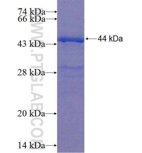 SLCO5A1 fusion protein Ag22652 SDS-PAGE