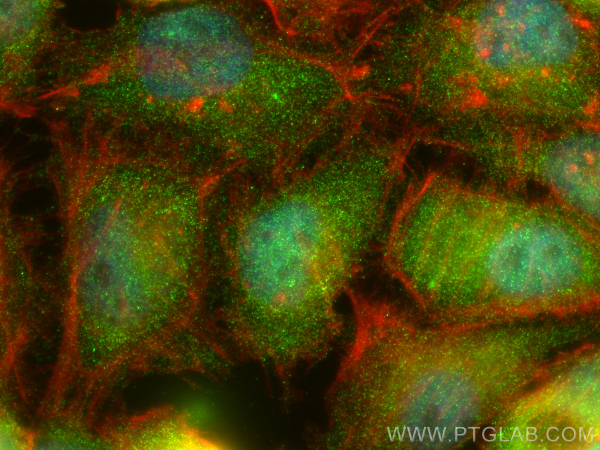 Immunofluorescence (IF) / fluorescent staining of HeLa cells using SLD5 Polyclonal antibody (13315-1-AP)