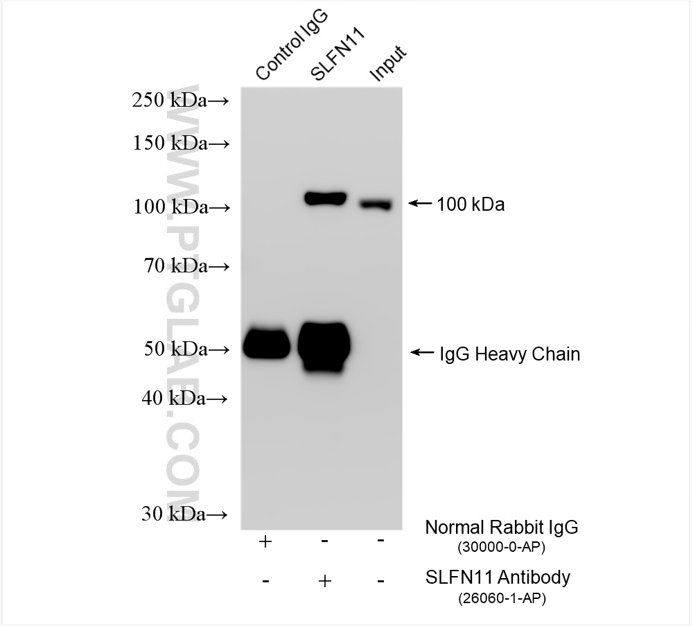 Immunoprecipitation (IP) experiment of HEK-293 cells using SLFN11 Polyclonal antibody (26060-1-AP)