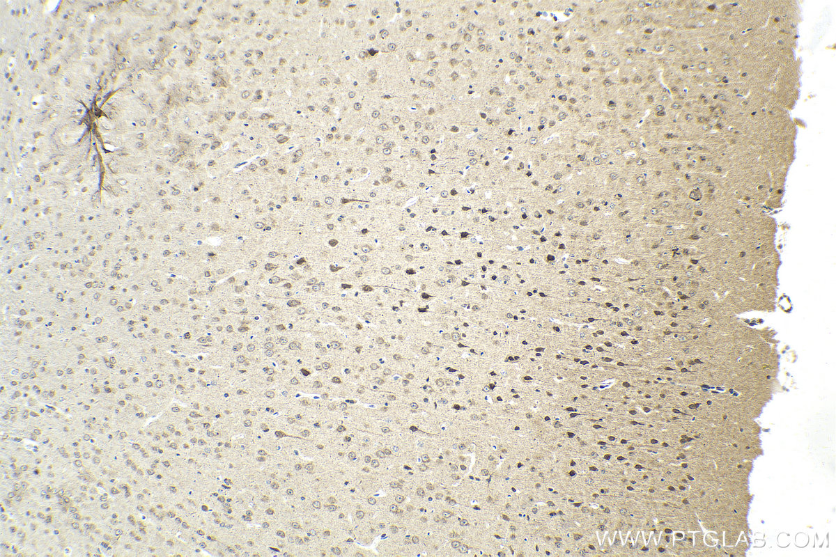 Immunohistochemistry (IHC) staining of mouse brain tissue using SLITRK3 Polyclonal antibody (21649-1-AP)