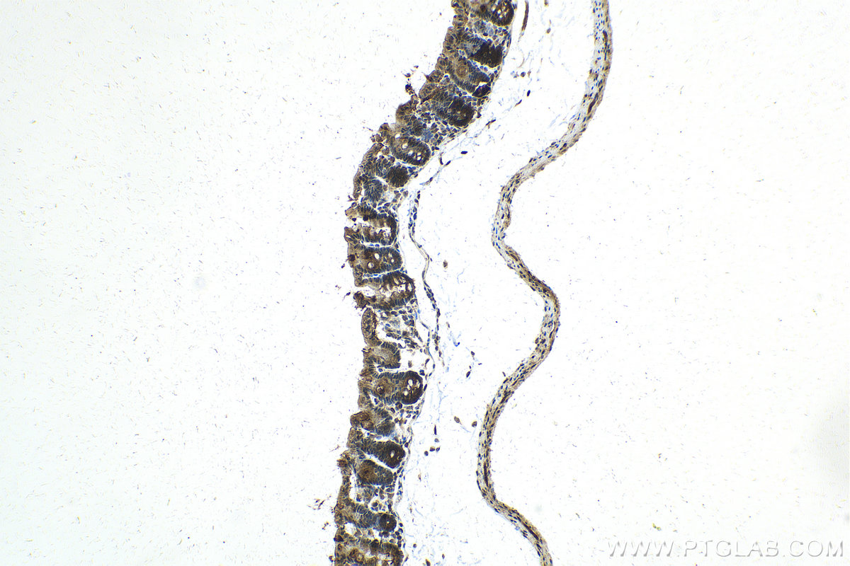 Immunohistochemistry (IHC) staining of mouse intestine using SLITRK3 Polyclonal antibody (21649-1-AP)