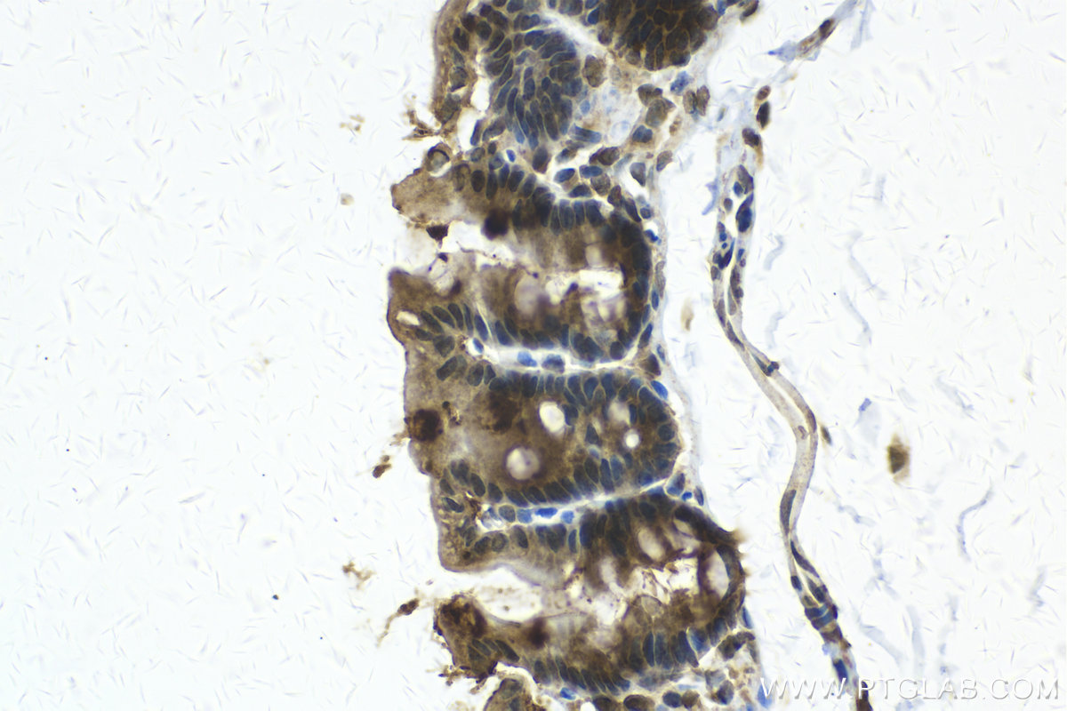 Immunohistochemistry (IHC) staining of mouse intestine using SLITRK3 Polyclonal antibody (21649-1-AP)