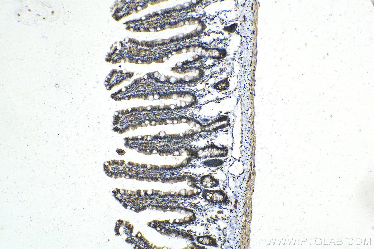 Immunohistochemistry (IHC) staining of rat small intestine tissue using SLITRK3 Polyclonal antibody (21649-1-AP)