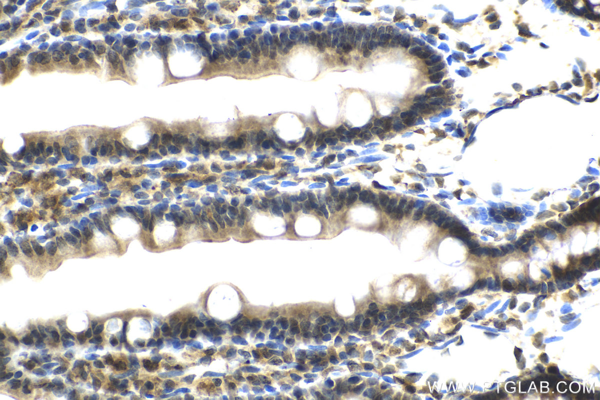 Immunohistochemistry (IHC) staining of rat small intestine tissue using SLITRK3 Polyclonal antibody (21649-1-AP)