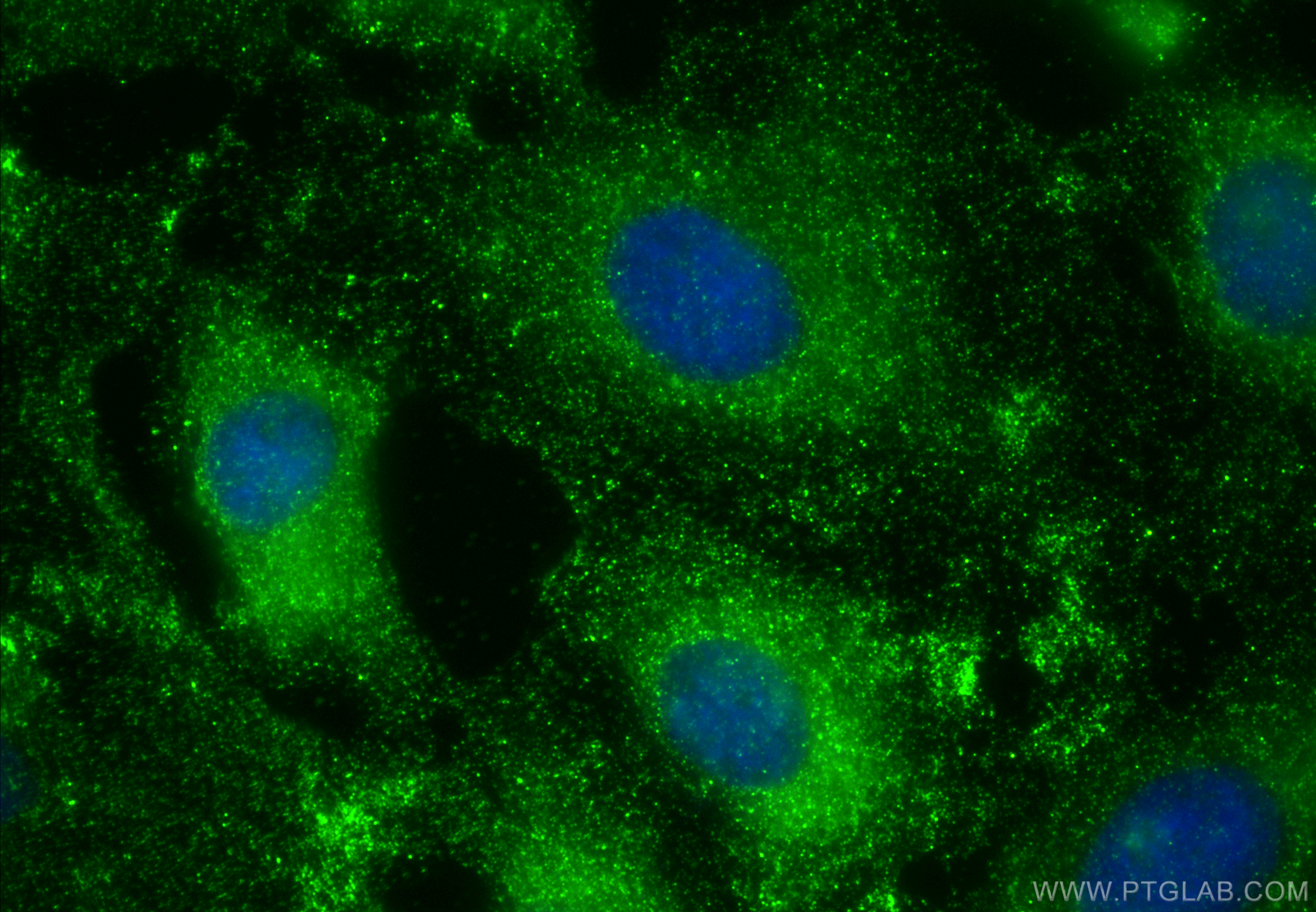 Immunofluorescence (IF) / fluorescent staining of HeLa cells using SLP76 Monoclonal antibody (66465-1-Ig)