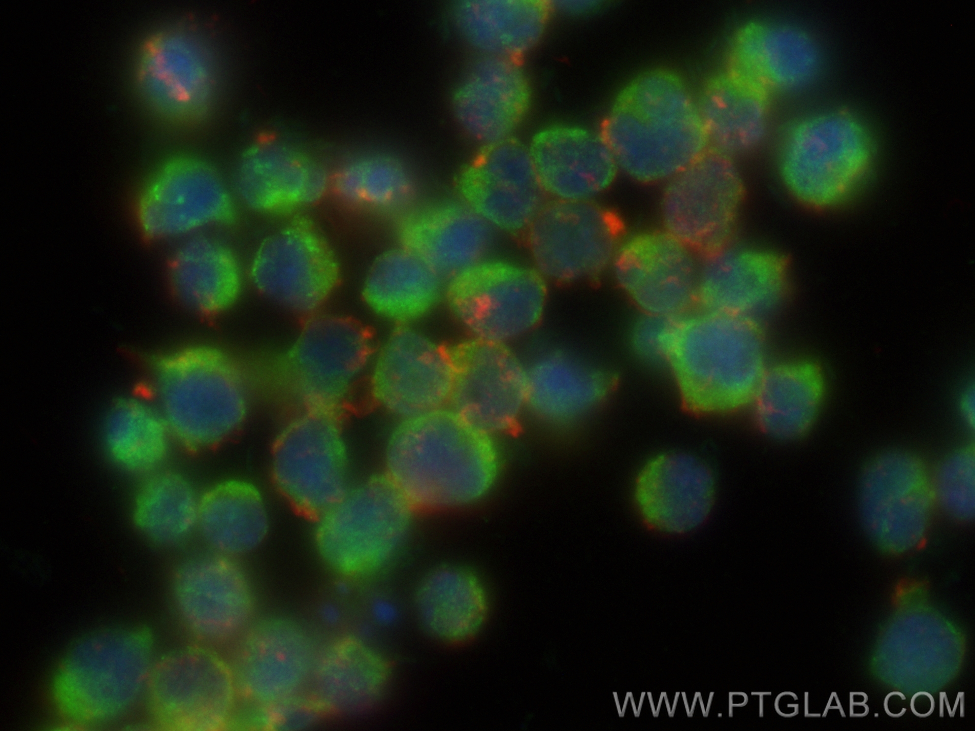 Immunofluorescence (IF) / fluorescent staining of Jurkat cells using CoraLite® Plus 488-conjugated SLP76 Polyclonal ant (CL488-12728)