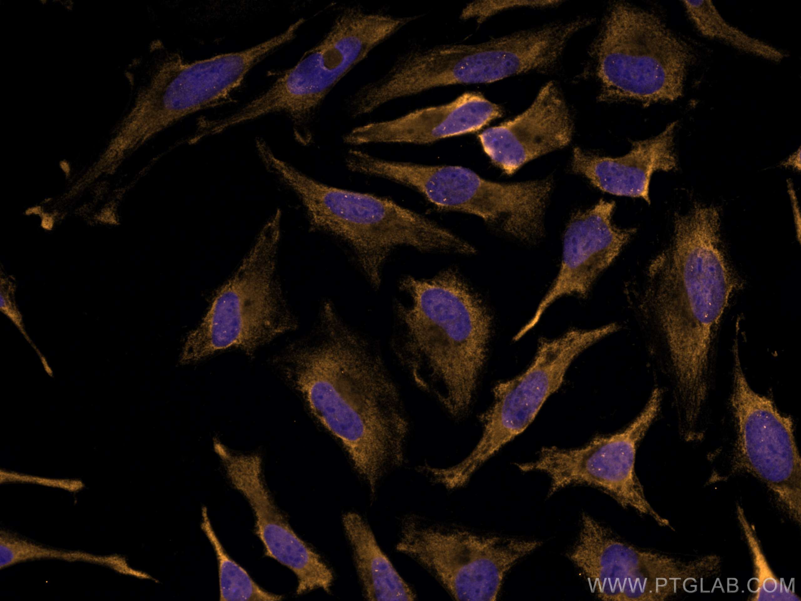 Immunofluorescence (IF) / fluorescent staining of HeLa cells using CoraLite®555-conjugated SLP76 Monoclonal antibody (CL555-66465)