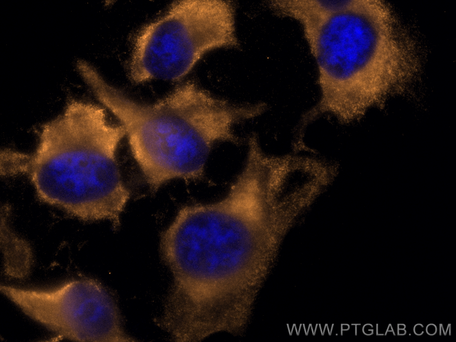 Immunofluorescence (IF) / fluorescent staining of HeLa cells using CoraLite®555-conjugated SLP76 Monoclonal antibody (CL555-66465)