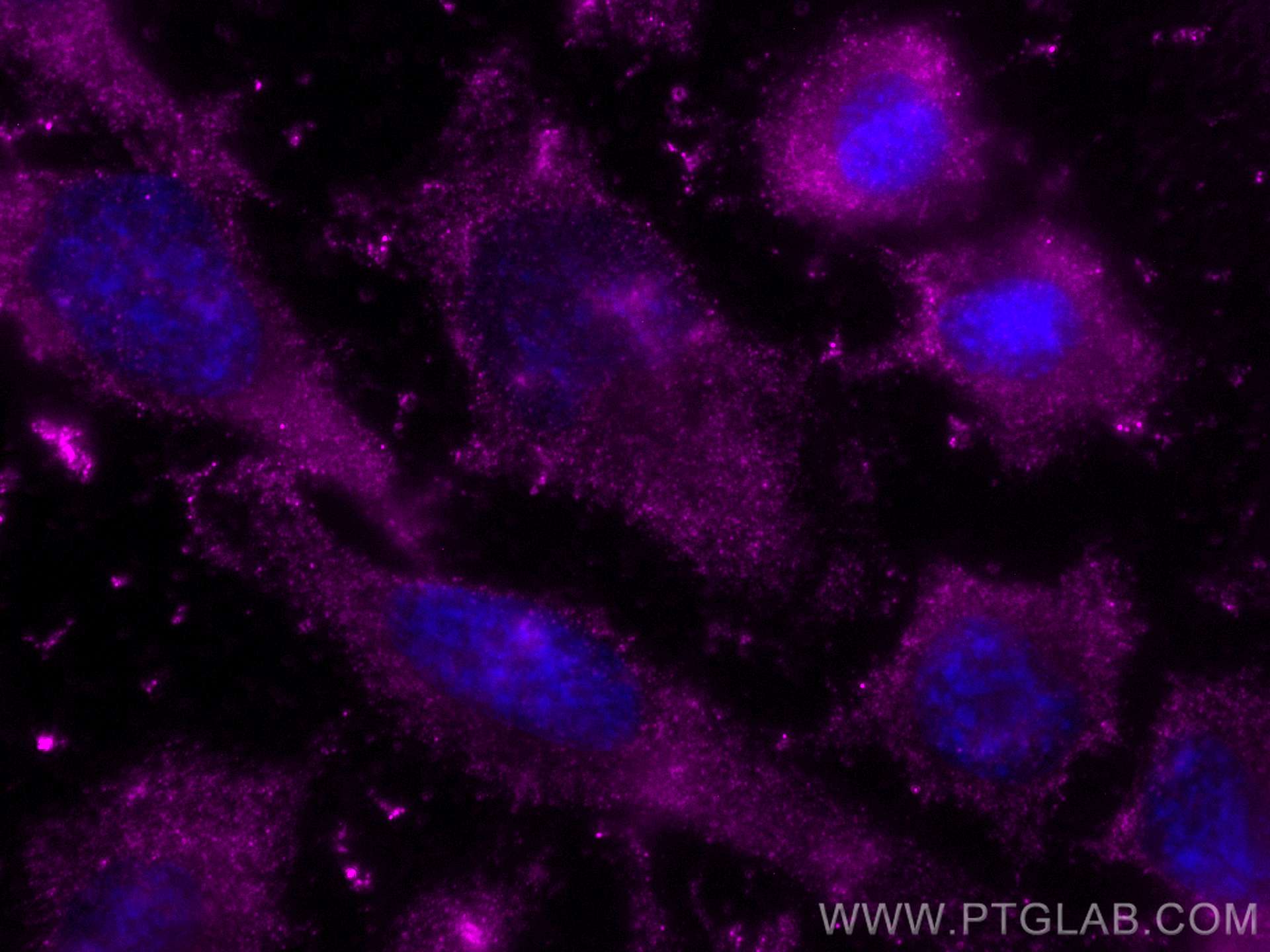 Immunofluorescence (IF) / fluorescent staining of HeLa cells using CoraLite® Plus 647-conjugated SLP76 Monoclonal ant (CL647-66465)