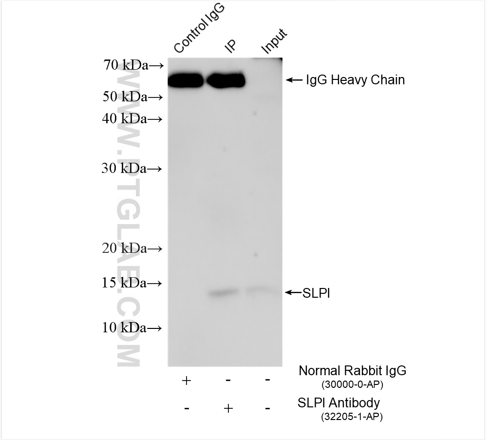 Immunoprecipitation (IP) experiment of HeLa cells using SLPI Polyclonal antibody (32205-1-AP)