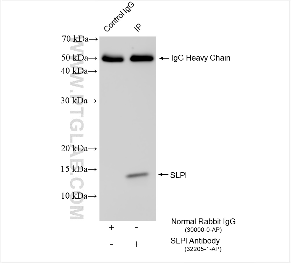 Immunoprecipitation (IP) experiment of HeLa cells using SLPI Polyclonal antibody (32205-1-AP)