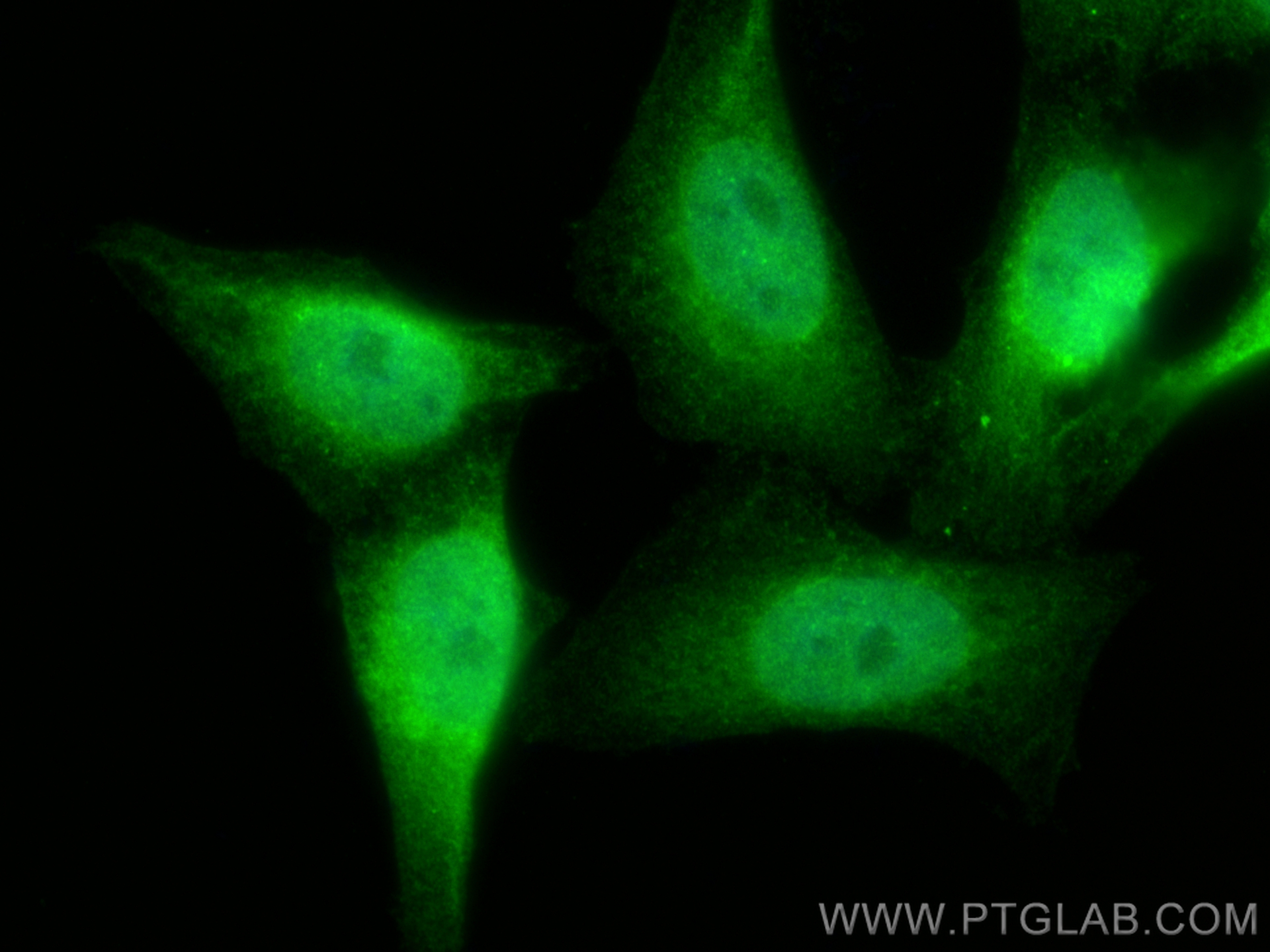 Immunofluorescence (IF) / fluorescent staining of HepG2 cells using SMAD2 Polyclonal antibody (12570-1-AP)