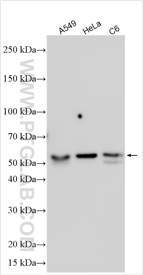 Western Blot (WB) analysis of various lysates using SMAD2 Polyclonal antibody (12570-1-AP)