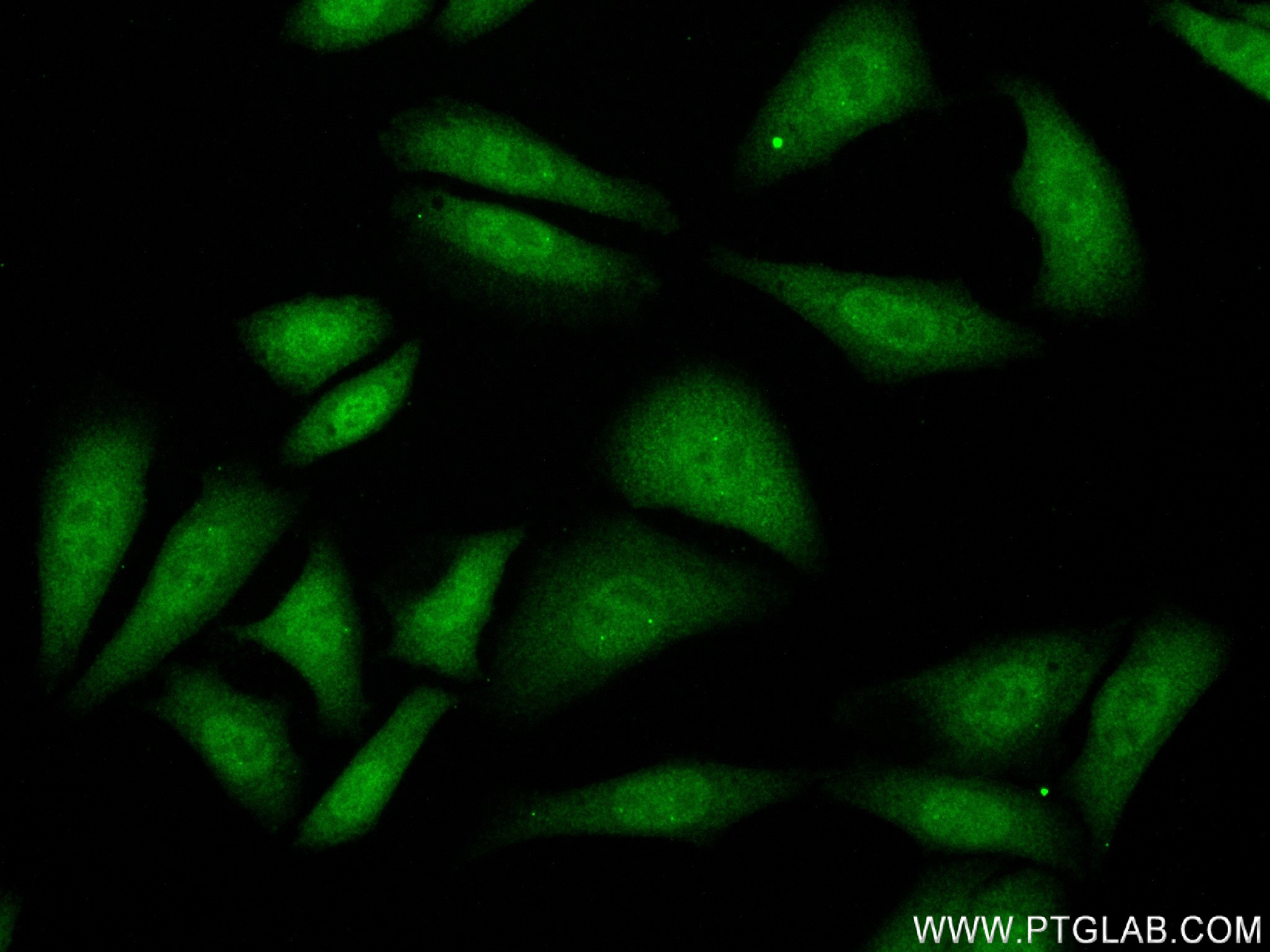 Immunofluorescence (IF) / fluorescent staining of HepG2 cells using SMAD2 Recombinant antibody (83841-4-RR)