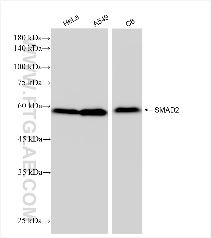 Western Blot (WB) analysis of various lysates using SMAD2 Recombinant antibody (83841-4-RR)