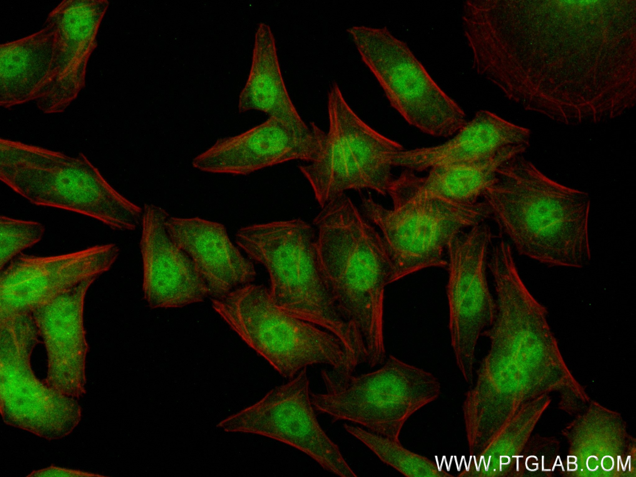 Immunofluorescence (IF) / fluorescent staining of HepG2 cells using SMAD2 Recombinant antibody (83841-5-RR)